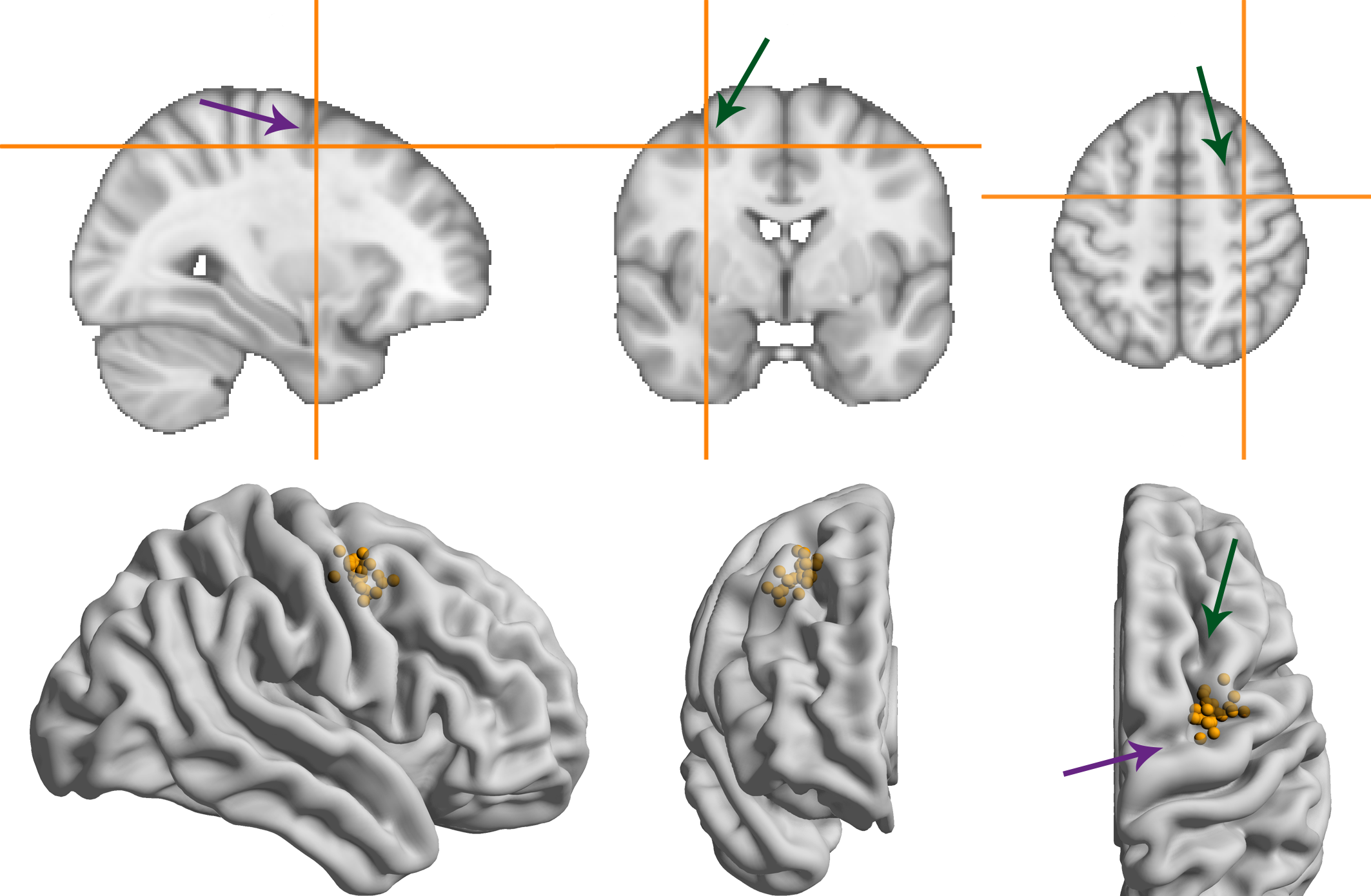 MNI coordinates of the right frontal eye field. Green/more vertical arrows indicate the superior frontal sulcus, purple/more horizontal arrows indicate the pre-central sulcus. (A) Average MNI coordinate across participants. (B) Coordinates for individual participants overlaid on a glass brain representation of the MNI template using Surf Ice software (Rorden, 2017).